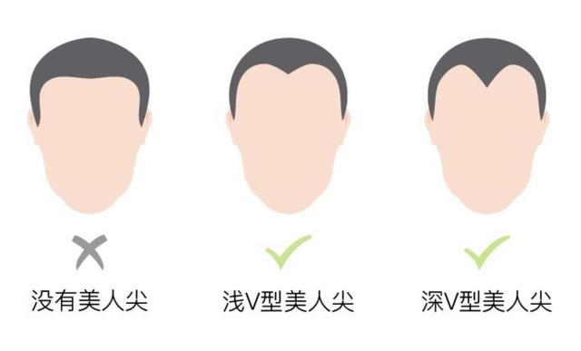 本以为自己有了美人尖 没想到竟然是m型脱发 扎心了 太阳信息网