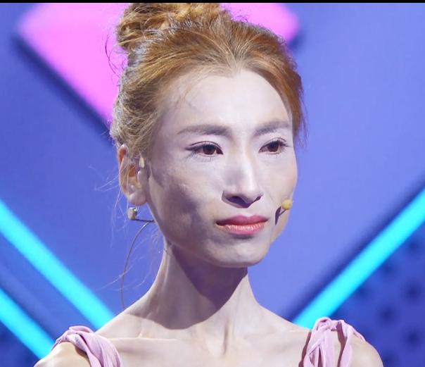 "骷髅妹"刘野为爱痴狂,从120斤瘦到58斤,不料男友已有未婚妻