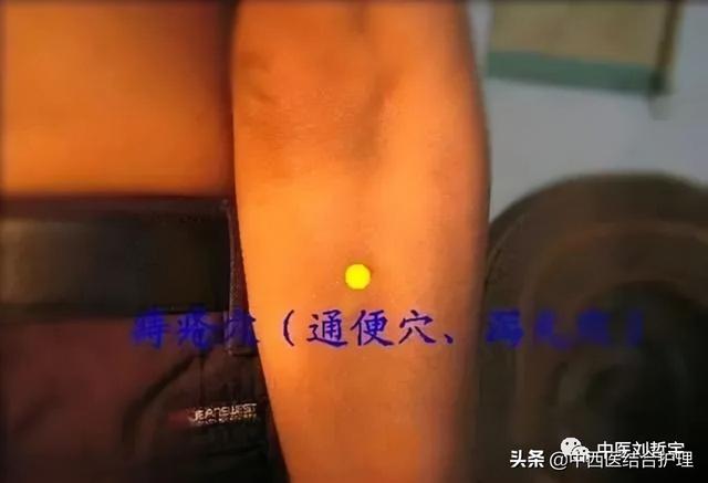 「穴位养生」上肢部常用平衡穴位（共11穴），超使用哦