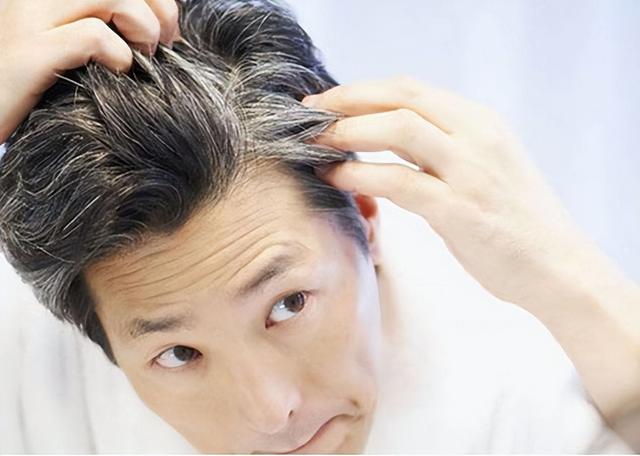 白发长在哪，暗示病从哪出？长在两鬓、前额、后脑勺分别说明什么