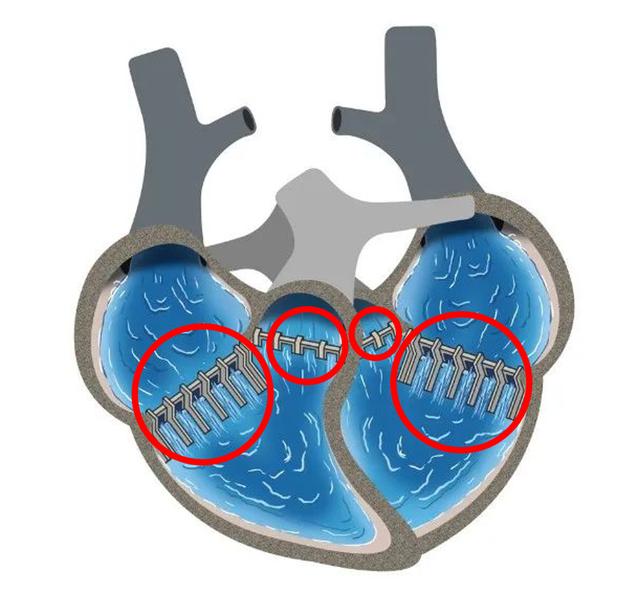 心脏是怎么长大的：第2篇——满是“漏洞”的心脏