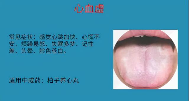 怕冷就补阳？血虚也会！6种血虚情况，实用中成药大总结