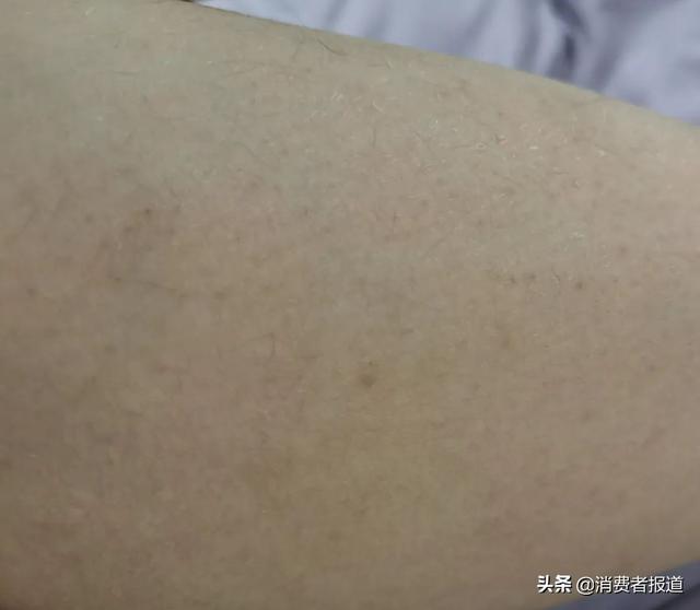 身体乳发酸
