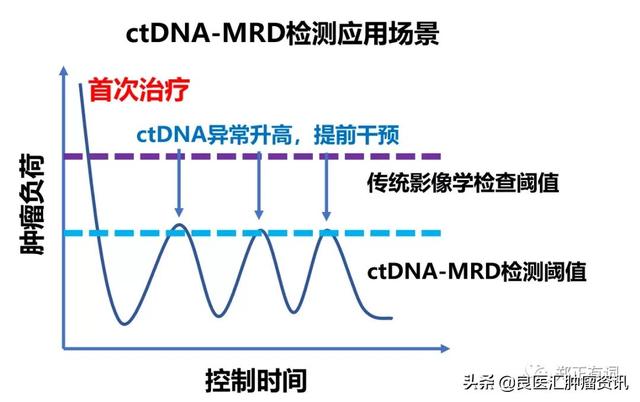 專家說：PET/CT都看不見的復發病灶，它卻能發現