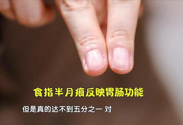 手指甲满足3个特点，多半是身体在“求救”！赶紧自测
