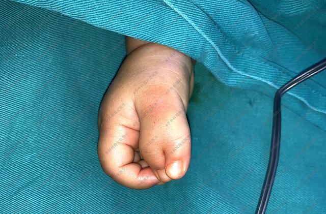 如何生出一个手足健康的宝宝？这不仅是妈妈的事，爸爸也该看看