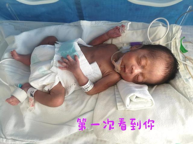 家有早产儿（前篇）