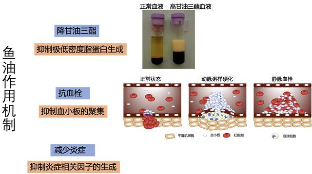 关注心脑血管健康：鱼油和辅酶Q10对改善心脑血管功能有帮助吗