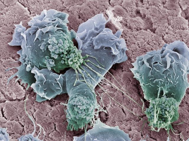 ca724he和细胞角化蛋白片段