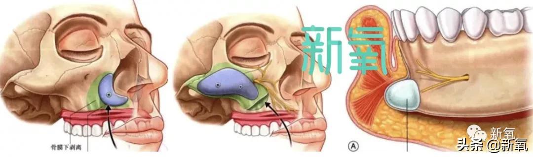 沃拉娜特旺萨莞