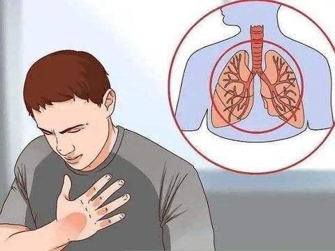 黄痰属热，白痰是寒？中医提醒：咳出4类痰液，多关注肺健康