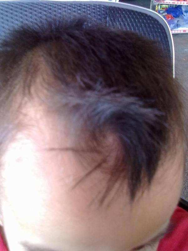 孩子头上的"旋"代表什么?与智商和性格有关吗?今天告诉你答案
