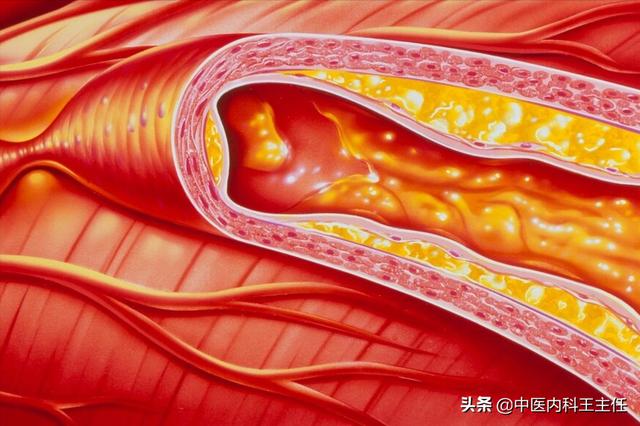 中医送你一张健脾祛湿的千古名方，请收藏