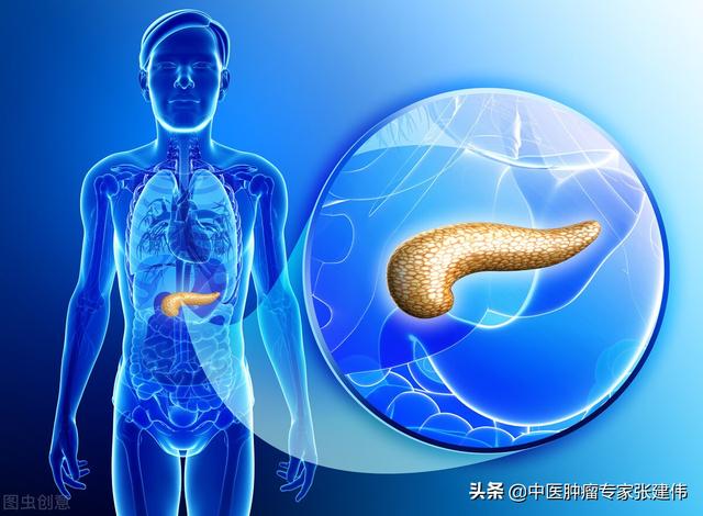 “胃病”患者出現這6個表現，當心是胰腺癌“信號”，千萬別忽視