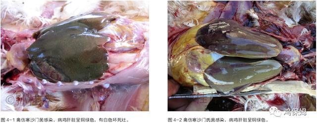 鸡皮肤是不传染
