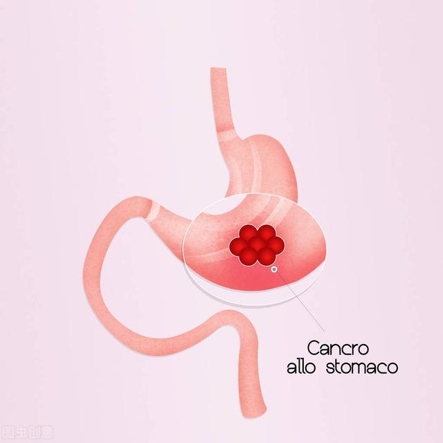 ca724he和细胞角化蛋白片段