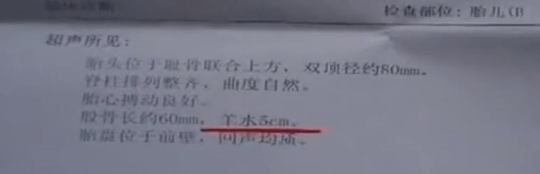 山东一产妇刚生孩子，一个月后又要临产，医生：从未见过这种情况
