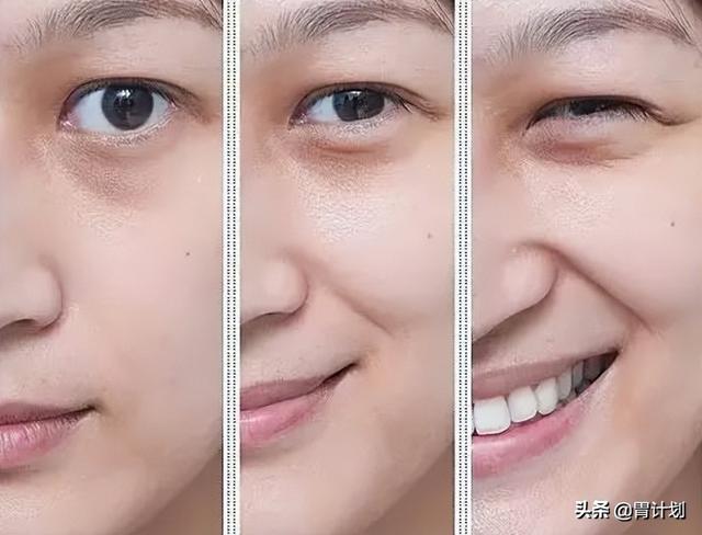 脸部衰老快是哪里出问题了（女人的脸上若出现这5种现象）(1)