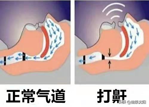 世界睡眠日 | 睡得好？睡不好？