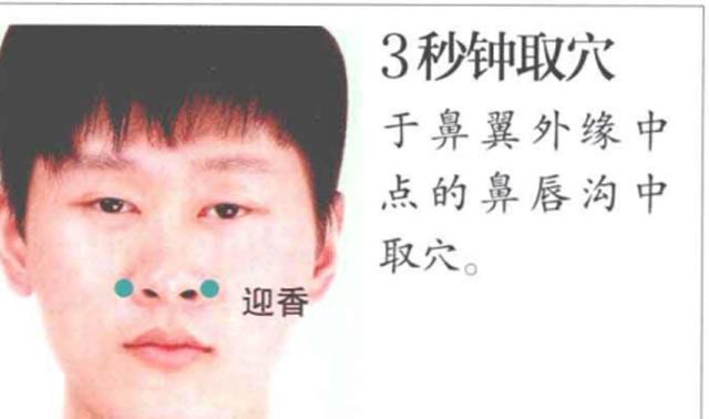 迎香穴——调理各种颜面疾患的要穴