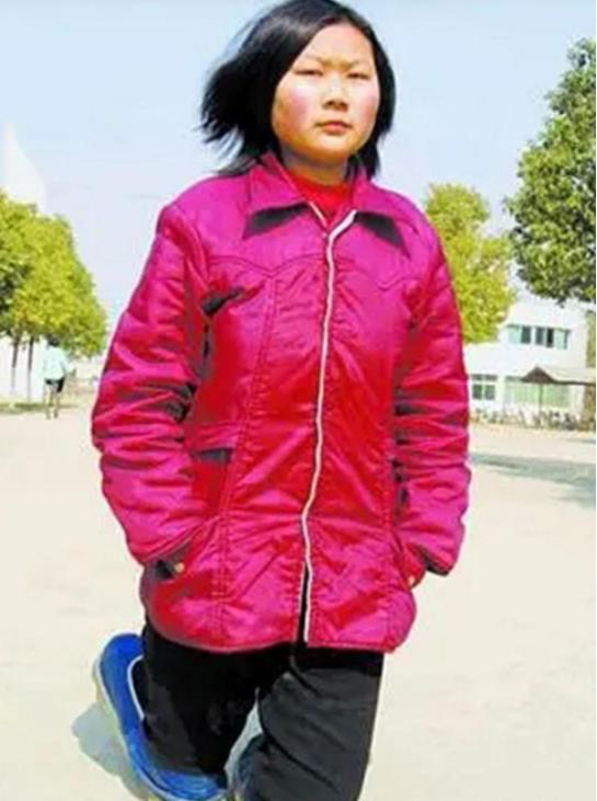 折翼天使顽强产婴，34岁四肢截肢孕妇，靠腕部发力顺利当妈