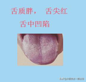 临床常见的9种舌象，对照自测
