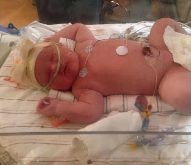 1983年，那个出生就14.5斤，轰动全美的巨婴，如今过得怎么样？