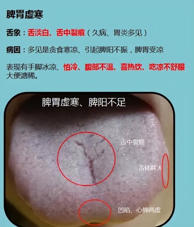 舌象分析，看看正常的和异常的舌象对比