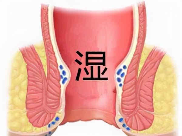 肛门角化型湿疹