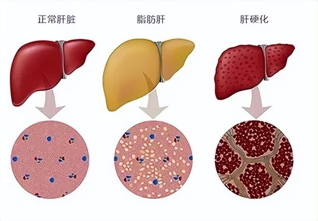 吃油过多正在“毁坏”您的健康！油要这样吃才健康