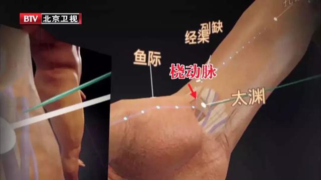 高血压是啥引起的