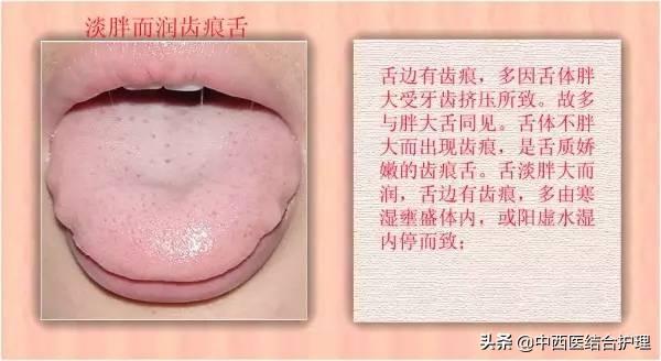 「舌诊科普」中医医生总看舌头都在看什么？奉上珍贵的舌诊图谱