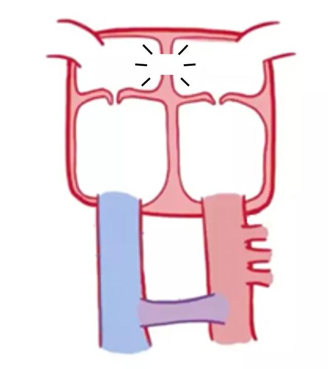 心脏是怎么长大的：第2篇——满是“漏洞”的心脏