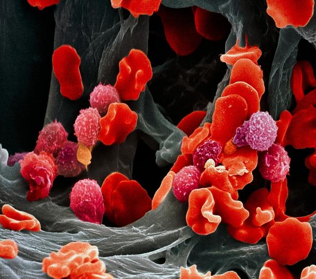 ca724he和细胞角化蛋白片段