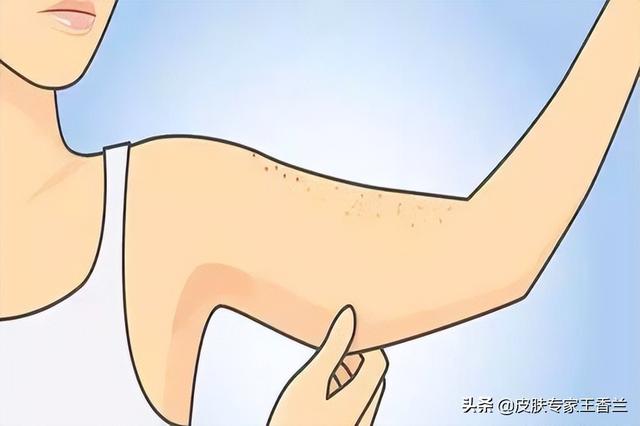 如何治鸡皮肤是什么样