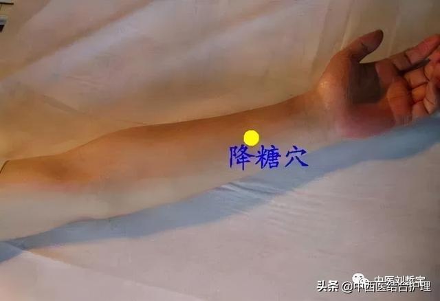 「穴位养生」上肢部常用平衡穴位（共11穴），超使用哦
