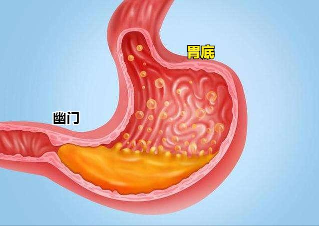 人的胃什么样子图片图片