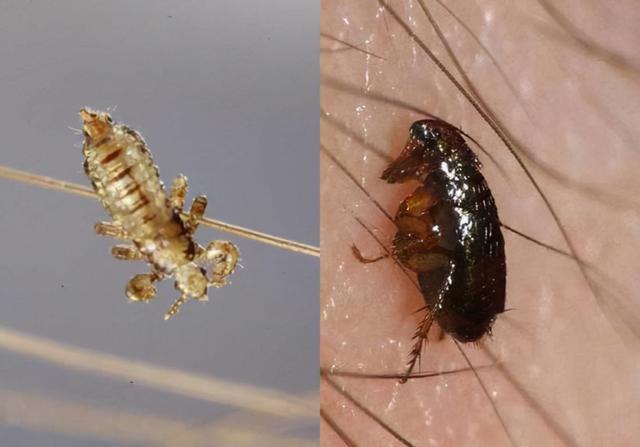 虱子怎么治(牛身上长虱子怎么治) | 伯乐创业网