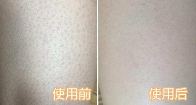 鸡皮肤哪个牌子好