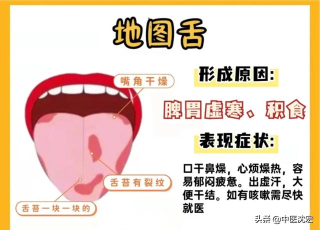 中医：从舌头看健康，舌象分析，常见的6种舌苔问题！和调理建议
