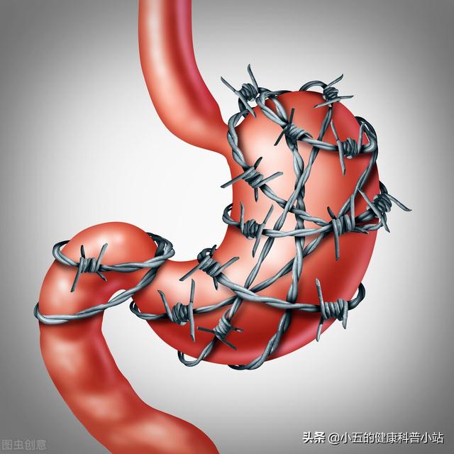 得了慢性萎缩性胃炎不可怕，科学使用4类药物，积极预防病情发展