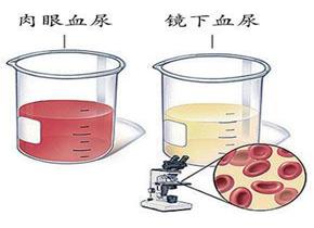 检查尿是阴性什么意思