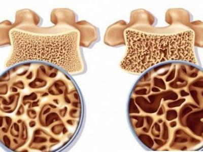 如何让补钙事半功倍？
