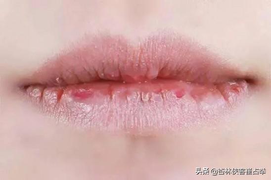 心火旺、肝火旺、胃火旺？看舌头发出的这些信号！提醒你要注意了