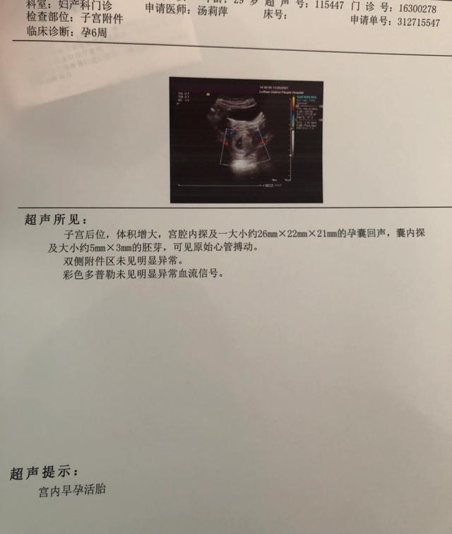 二胎想要个女儿