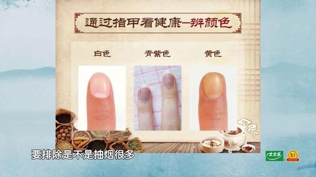手指甲满足3个特点，多半是身体在“求救”！赶紧自测