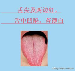 临床常见的9种舌象，对照自测