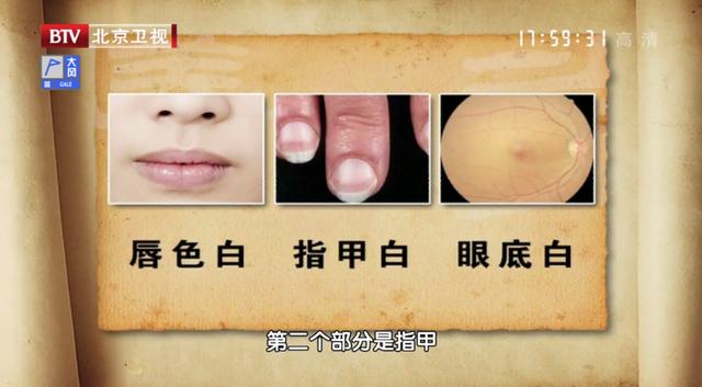 上了年纪，容易气血不足！鸡蛋和一物经常煮着吃，养气血又活血