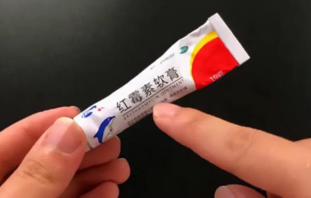 皮肤脂溢性角化症擦什么药膏