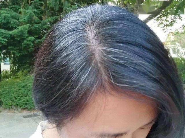 人体缺哪种物质会长白发白发为什么不能拔掉不妨来了解一下 新闻时间